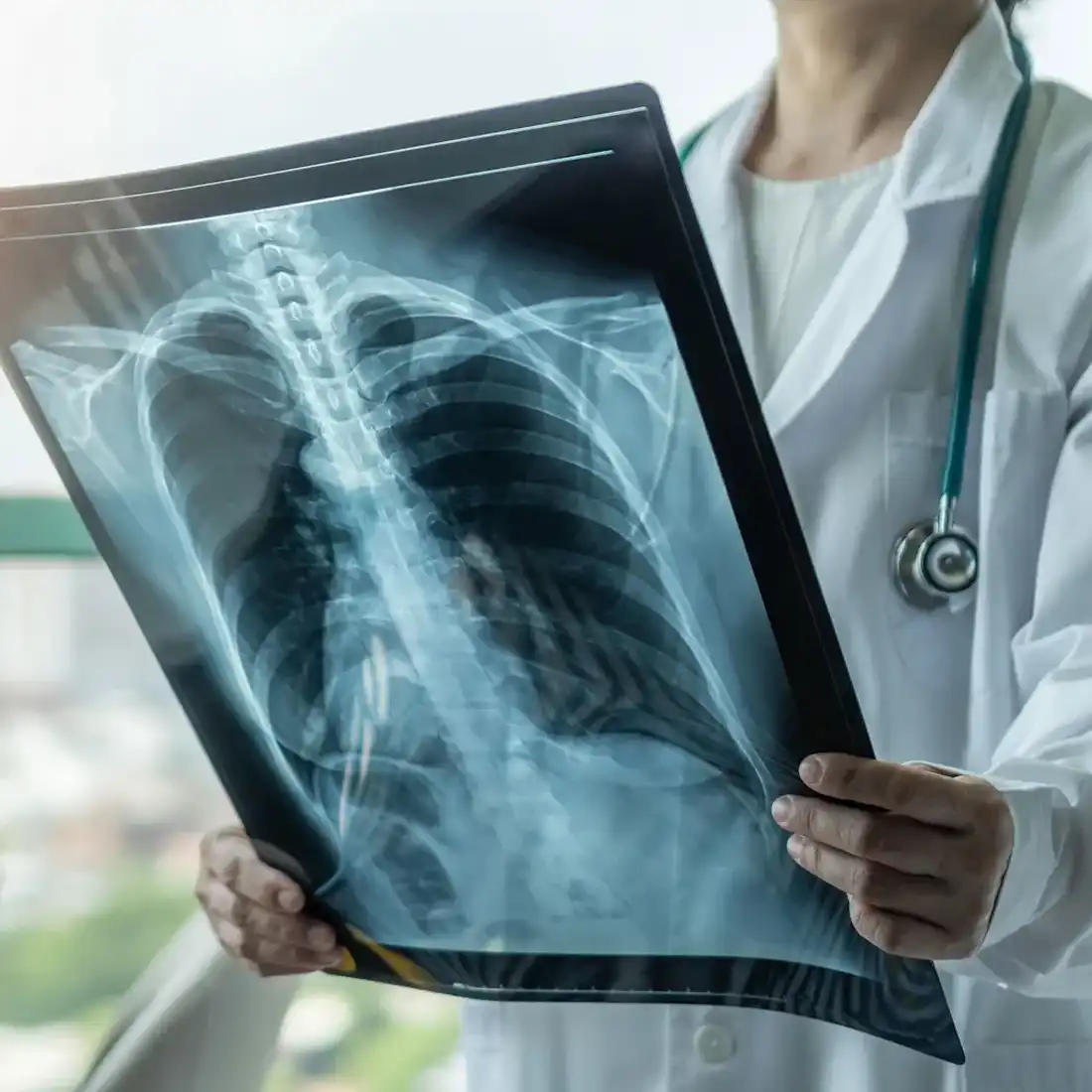 specialties_Pulmonary Inspire Post Acute Specialists: Pulmonary